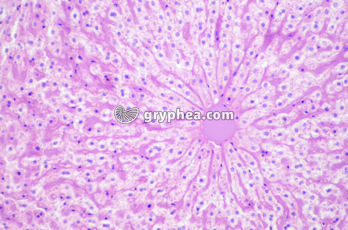 Veinule centro-lobaire dans lobule hépatique CT x40 - gryphea.com